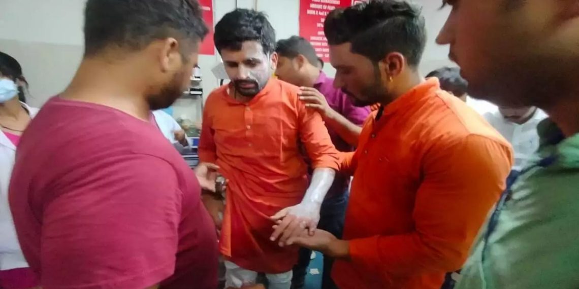 भाजयुमो की रैली में हुआ बड़ा धमाका, नवनियुक्त प्रदेश अध्यक्ष शशांक रावत सहित कई कार्यकर्ता घायल