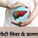 चिंता का विषय है फैटी लीवर की बढ़ती बीमारी